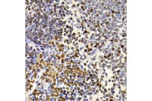 Immunohistochemistry of paraffin-embedded rat spleen using HIRIP3 antibody at dilution of 1:100 (x400 lens). (HIRIP3 抗体)