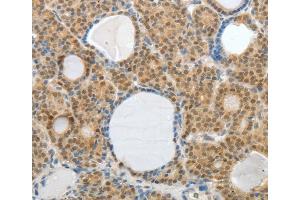 Immunohistochemistry (IHC) image for anti-A Kinase (PRKA) Anchor Protein 6 (Akap6) antibody (ABIN2426541) (AKAP6 抗体)