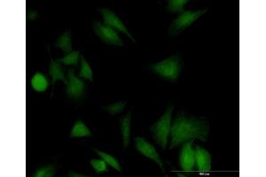 Immunofluorescence of monoclonal antibody to UBE2G1 on HeLa cell. (UBE2G1 抗体  (AA 1-170))