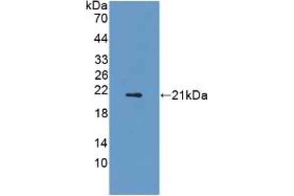 Adiponectin Receptor 2 抗体  (AA 1-147)