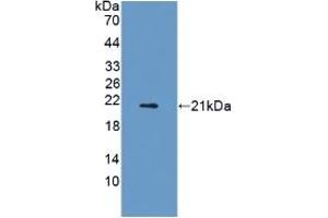 Detection of Recombinant ADIPOR2, Rat using Polyclonal Antibody to Adiponectin Receptor 2 (ADIPOR2)
