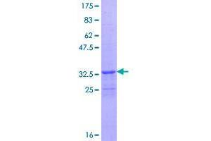 FBXL21 Protein (AA 1-70) (GST tag)