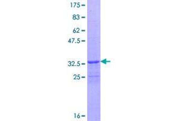 FBXL21 Protein (AA 1-70) (GST tag)