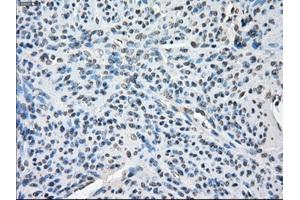 Immunohistochemical staining of paraffin-embedded colon tissue using anti-BUB1Bmouse monoclonal antibody. (BUB1B 抗体)