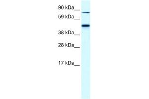 EPB42 antibody used at 0. (EPB42 抗体  (Middle Region))
