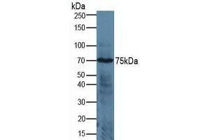Detection of ADAM17 in Human Jurkat Cells using Polyclonal Antibody to A Disintegrin And Metalloprotease 17 (ADAM17) (ADAM17 抗体  (AA 226-473))
