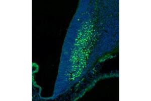 (ABIN6244147 and ABIN6577773) staining SKOR2 in mouse cerebellum at embryonic stage 12.