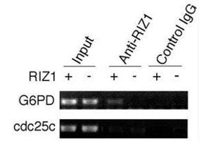 ChIP analysis was performed on RIZ1 knockout mouse embryonic fibroblasts with RIZ1 antibody. (PRDM2 抗体  (AA 1-347))
