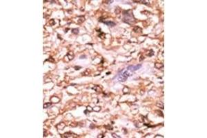 Image no. 2 for anti-Tumor Protein P53 (TP53) (pThr18) antibody (ABIN358195) (p53 抗体  (pThr18))