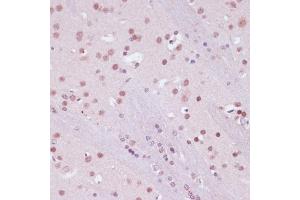 Immunohistochemistry of paraffin-embedded mouse brain using KDM1 antibody (ABIN7268323) at dilution of 1:100 (40x lens).
