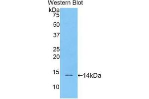 Western blot analysis of the recombinant protein. (Resistin 抗体  (AA 21-114))