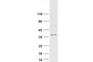 Western Blotting (WB) image for Toll-Interleukin 1 Receptor (TIR) Domain Containing Adaptor Protein (TIRAP) (Transcript Variant 3) protein (Myc-DYKDDDDK Tag) (ABIN2733787)