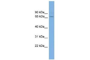 WB Suggested Anti-GAD1 Antibody Titration: 0. (GAD 抗体  (N-Term))