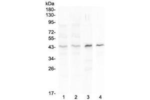 Western blot testing of 1) human placenta, 2) human MCF7, 3) rat spleen and 4) mouse spleen lysate with SP6 antibody at 0. (SP6 抗体)