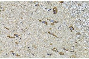 Immunohistochemistry of paraffin-embedded Rat spinal cord using ADRBK2 Polyclonal Antibody at dilution of 1:100 (40x lens). (ADRBK2 抗体)