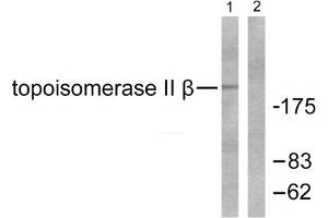 Western blot analysis of extracts from Jurkat cells, using Topoisomerase II beta antibody.