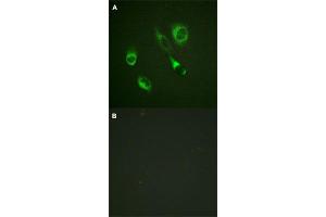 Immunofluorescence staining of methanol-fixed HeLa cells with EPHA2/EPHA3/EPHA4 (phospho Y588/Y596) polyclonal antibody  without blocking peptide (A) or preincubated with blocking peptide (B) at 1:100-1:200 dilution. (EPH Receptor A2 抗体  (pTyr588, pTyr596))