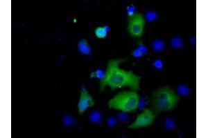 Image no. 4 for anti-Acetyl-CoA Acetyltransferase 2 (ACAT2) antibody (ABIN1496397) (ACAT2 抗体)