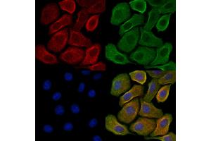 ABIN7093304 and ABIN7097323 staining H2O2 treated Hela cells by IF/ICC. (ERK1/2 抗体  (pTyr205, pTyr222))