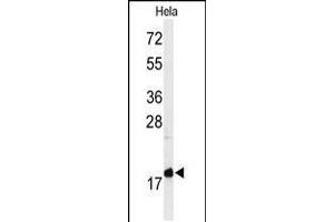 Western blot analysis of MMGT1 Antibody in Hela cell line lysates (35ug/lane) (MMGT1 抗体  (C-Term))