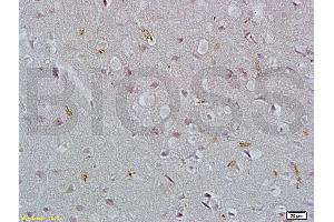 Formalin-fixed and paraffin embedded rat brain tissue labeled with Rabbit Anti-EpCAM/CD326 Polyclonal Antibody (ABIN670611), Unconjugated at 1:200 followed by conjugation to the secondary antibody and DAB staining. (EpCAM 抗体  (AA 53-150))