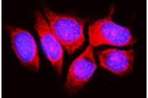 IF analysis of RPL11 using anti-RPL11 antibody (ABIN7602315). (RPL11 抗体  (AA 7-178))