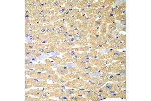 Immunohistochemistry of paraffin-embedded mouse heart using RPH3A antibody (ABIN6128668, ABIN6147094, ABIN6147096 and ABIN6217639) at dilution of 1:100 (40x lens).