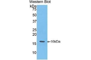 Western Blotting (WB) image for anti-Fast Skeletal Troponin T3a (TNNT3A) (AA 147-269) antibody (ABIN1176067) (TNNT3A 抗体  (AA 147-269))