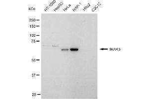 Western blotting analysis using IRAK3 antibody (ABIN7799115). (Recombinant IRAK3 抗体)