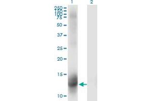 Western Blot analysis of NR3C2 expression in transfected 293T cell line by NR3C2 monoclonal antibody (M01), clone 2B5. (NR3C2 抗体  (AA 1-110))