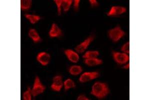 ABIN6266987 staining sw480 by IF/ICC. (KRT16 抗体  (N-Term))