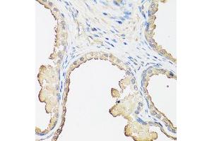 Immunohistochemistry of paraffin-embedded human prostate using B2M antibody.