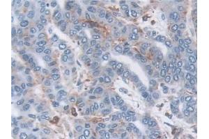 Immunohistochemistry (IHC) image for anti-Tripeptidyl Peptidase I (TPP1) (AA 1-320) antibody (ABIN7435157)
