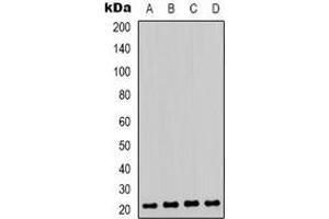 Western blot analysis of HP1 gamma (pS93) expression in Jurkat (A), K562 (B), A431 (C), Raw264. (CBX3 抗体  (pSer93))