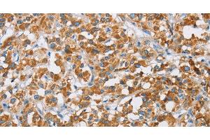 Immunohistochemistry (Paraffin-embedded Sections) (IHC (p)) image for anti-3-hydroxybutyrate Dehydrogenase, Type 1 (BDH1) antibody (ABIN7240898)