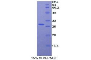 SDS-PAGE analysis of Rat aHSG Protein. (Fetuin A 蛋白)
