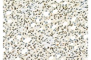 ABIN6263108 and ABIN6266800 at 1/100 staining Rat kidney tissue by IHC-P. (MAP3K6 抗体  (C-Term))