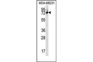 Western blot analysis of SIX5 Antibody  in MDA-MB231 cell line lysates (35ug/lane). (Six5 抗体  (Middle Region))