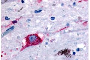 Anti-NPBWR2 antibody  ABIN1049112 IHC staining of human brain, neurons and glia. (NPBWR2 抗体  (N-Term))
