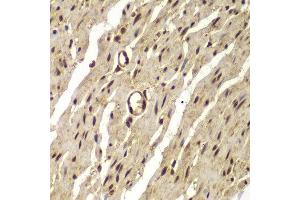 Immunohistochemistry (Paraffin-embedded Sections) (IHC (p)) image for anti-Proteasome (Prosome, Macropain) Subunit, beta Type, 8 (Large Multifunctional Peptidase 7) (PSMB8) (AA 163-272) antibody (ABIN6146321)