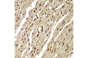 Immunohistochemistry of paraffin-embedded human colon using PSMB8 antibody. (PSMB8 抗体  (AA 163-272))