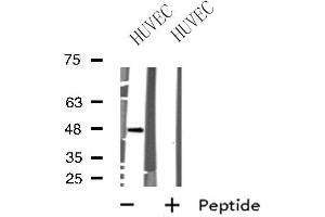 Western blot analysis of extracts from HUVEC cells, using BRS3 antibody. (BRS3 抗体  (Internal Region))