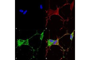 Immunocytochemistry/Immunofluorescence analysis using Mouse Anti-GABA-B Receptor 2 Monoclonal Antibody, Clone S81-2 (ABIN2484073). (GABBR2 抗体  (AA 861-912) (Atto 390))