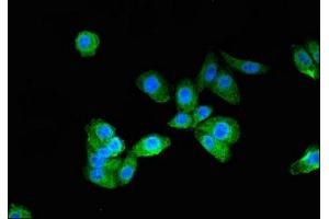 Immunofluorescent analysis of HepG2 cells using ABIN7165903 at dilution of 1:100 and Alexa Fluor 488-congugated AffiniPure Goat Anti-Rabbit IgG(H+L) (Patched 1 抗体  (AA 1180-1411))