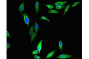 Immunofluorescent analysis of Hela cells using ABIN7149493 at dilution of 1:100 and Alexa Fluor 488-congugated AffiniPure Goat Anti-Rabbit IgG(H+L) (DAZAP1 抗体  (AA 1-300))