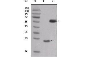 Western blot analysis using SRC mouse mAb against truncated SRC-His recombinant protein (1) and PMA treated THP-1 cell lysate (2). (Src 抗体  (AA 10-193))