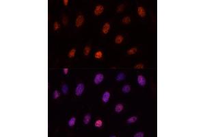 Immunofluorescence analysis of U-2OS cells using PCGF1 antibody (ABIN6129080, ABIN6145307, ABIN6145308 and ABIN6221952) at dilution of 1:100. (PCGF1 抗体  (AA 20-259))