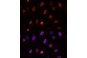 Immunofluorescence analysis of U-2OS cells using PCGF1 antibody (ABIN6129080, ABIN6145307, ABIN6145308 and ABIN6221952) at dilution of 1:100. (PCGF1 抗体  (AA 20-259))