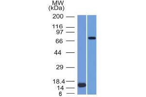 Western Blot of (1) Recombinant MMP2 protein and (2) U87 cell lysate using MMP2 Monoclonal Antibody (MMP2/1501). (MMP2 抗体  (AA 444-575))