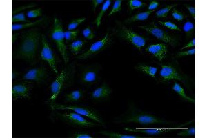 Immunofluorescence of purified MaxPab antibody to DNAJC30 on HeLa cell.